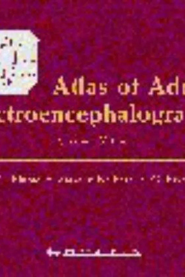 Capa de Atlas of adult electroencephalography