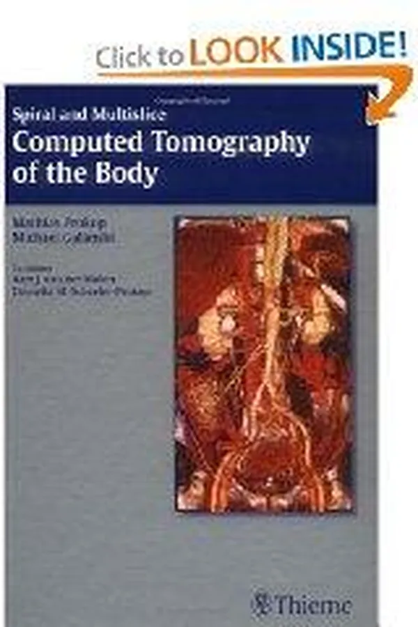 Capa de Spiral and multislice computed tomography of the body