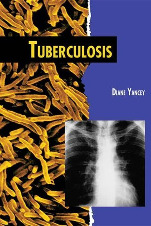 Capa de Tuberculosis