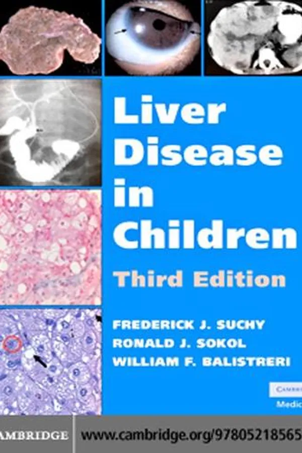 Capa de Liver Disease in Children