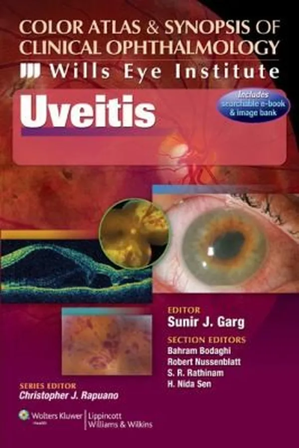 Capa de Uveitis With Web Access
            
                Color Atlas  Synopsis of Clinical Ophthalmology