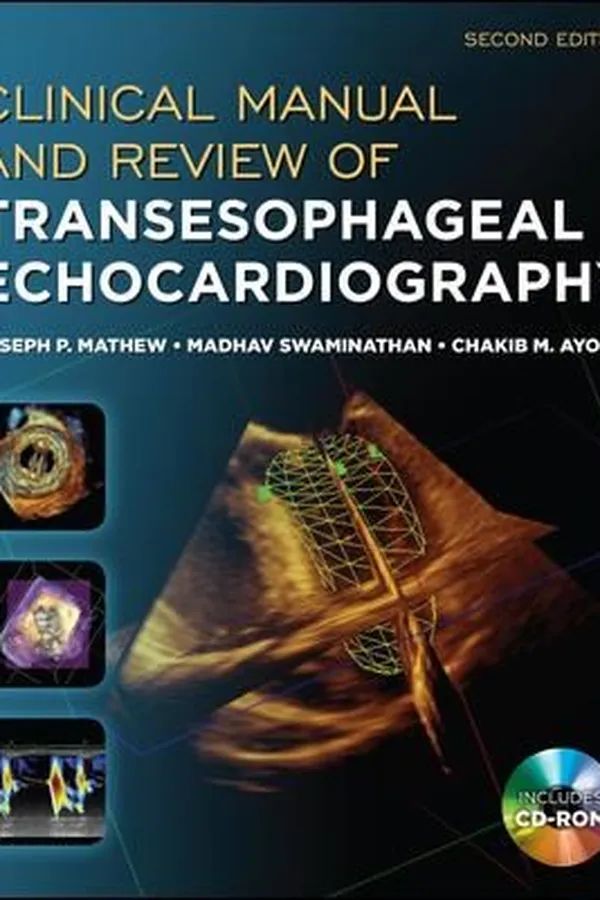 Capa de Clinical Manual and Review of Transesophageal Echocardiography Second Edition