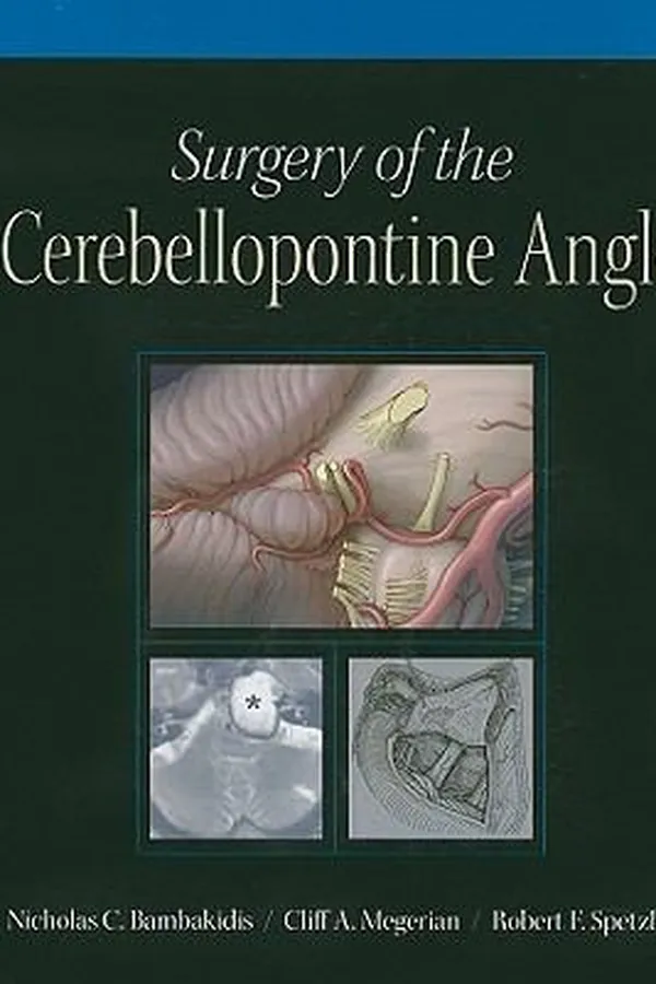 Capa de Surgery Of The Cerebellopontine Angle
