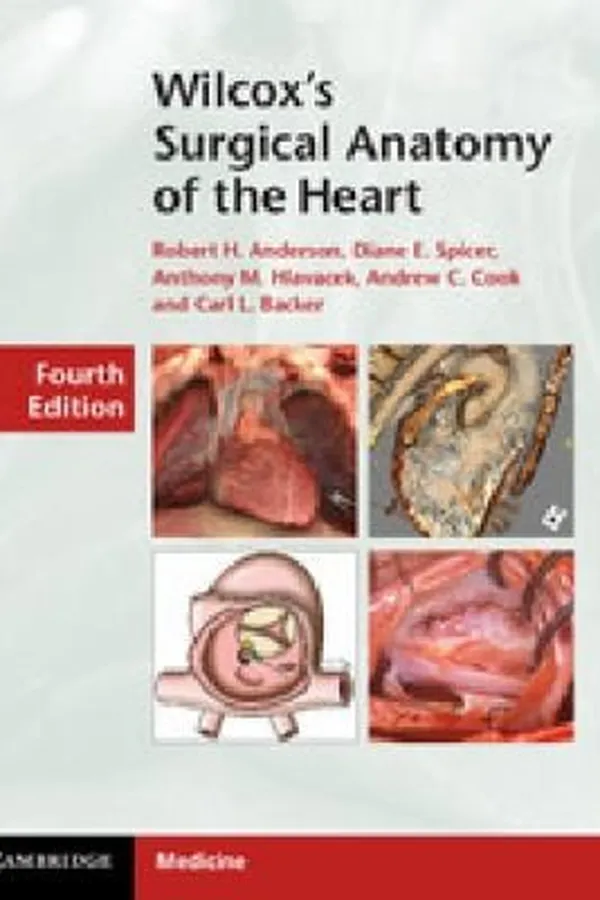 Capa de Wilcoxs Surgical Anatomy of the Heart
