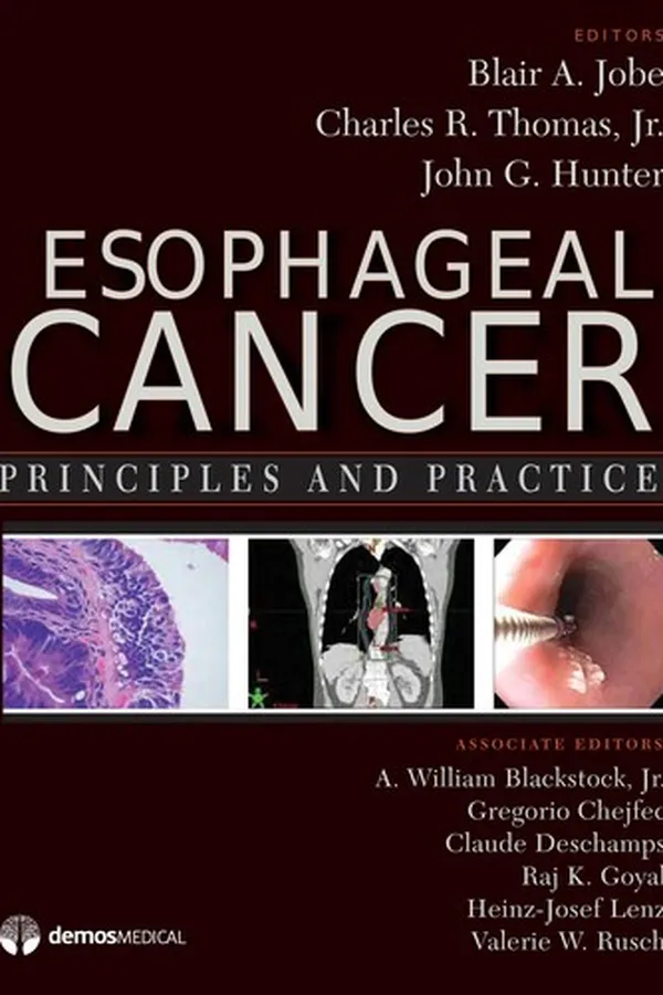 Capa de Esophageal cancer