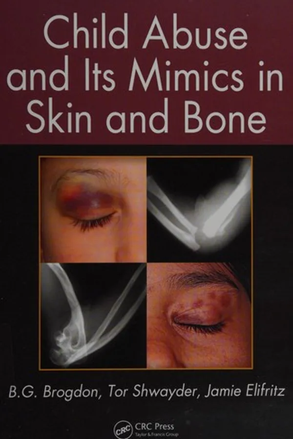 Capa de Child abuse and its mimics in skin and bone