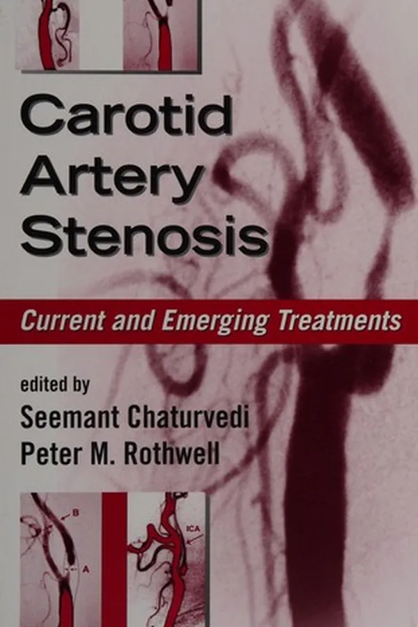 Capa de Carotid artery stenosis