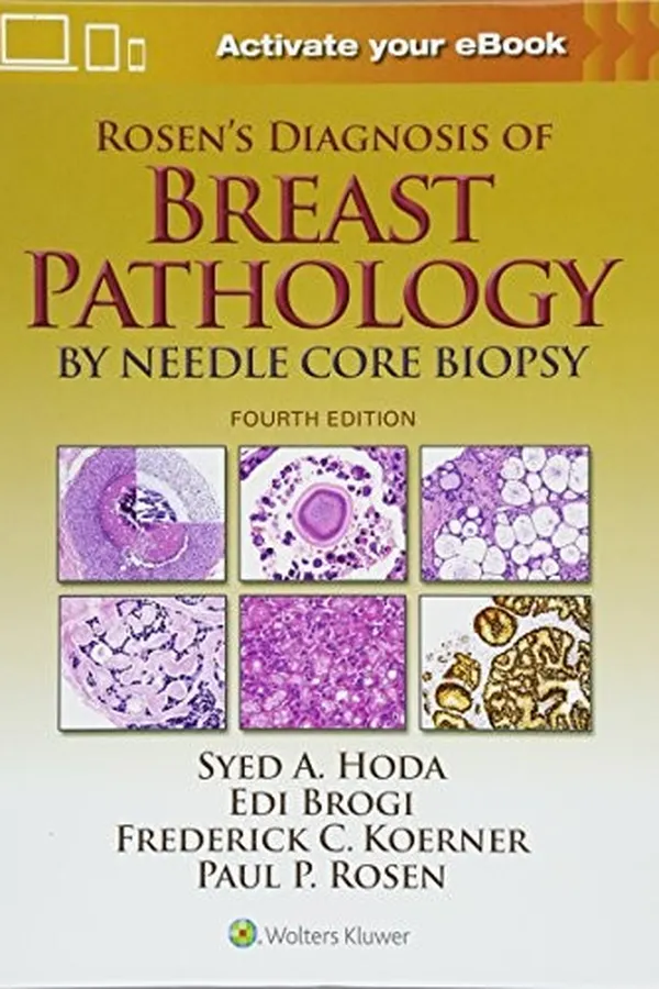 Capa de Rosen's Diagnosis of Breast Pathology by Needle Core Biopsy